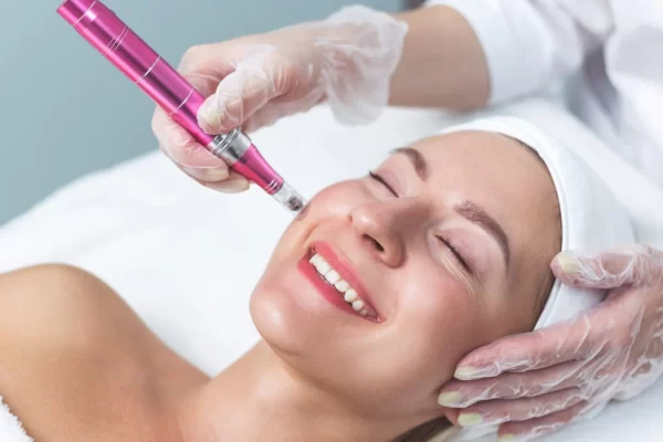 Microneedling​